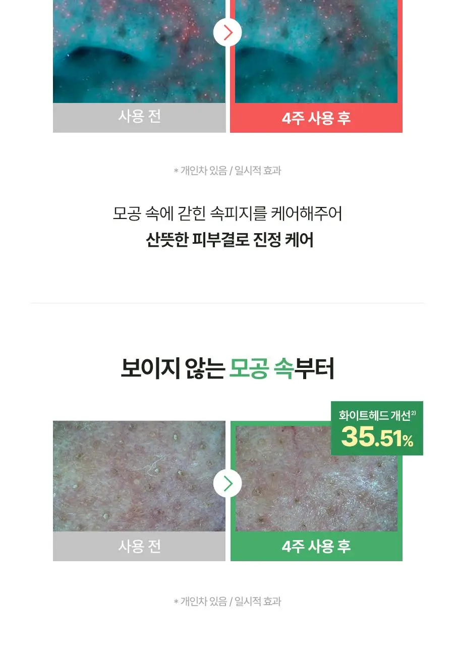 [코르티스PICK] 토리든 밸런스풀 시카 컨트롤 세럼 50ml 더블기획 (+20ml) 상세페이지 26